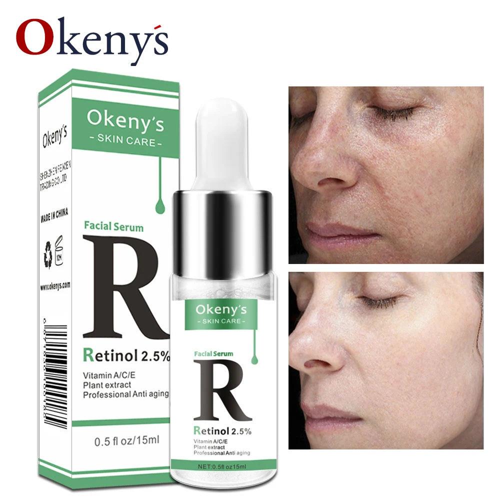 Radiant Skin Renewal Serum with Retinol & Vitamin C - Anti Wrinkle, Dark Spot Corrector, Collagen Booster  ourlum.com   