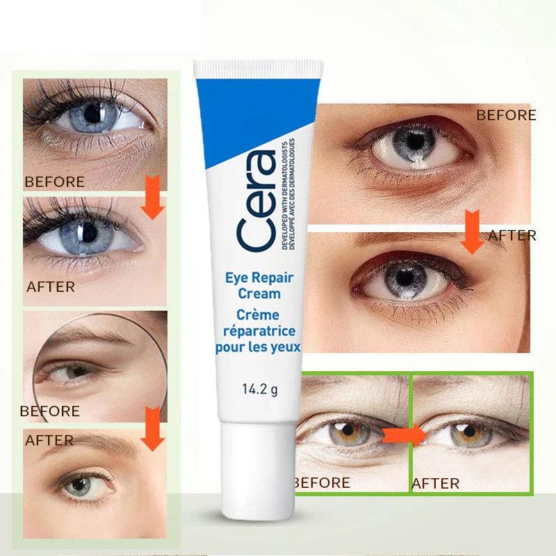 Ceramide Eye Cream Repair Skin Barrier For Dark Circles Under Eyes Puffiness Moisturizing Whitening Anti-Fine Lines Eye Care  ourlum.com   