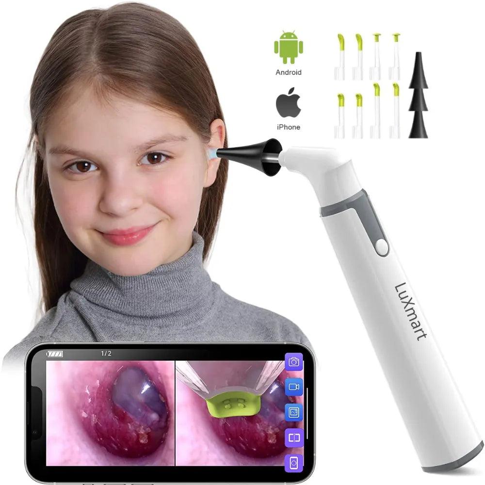 Wireless Otoscope: HD WiFi Ear Camera with LED Lights  ourlum.com   