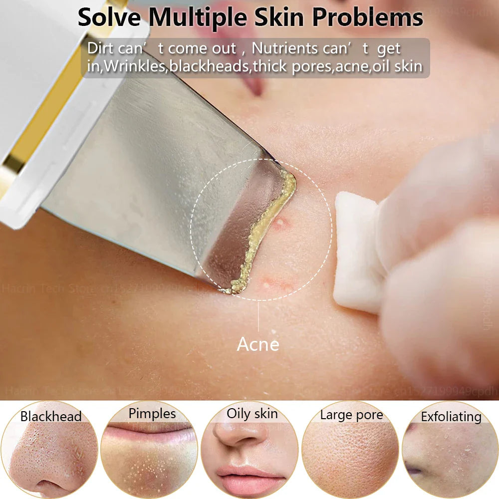 Ultrasonic Skin Scrubber Remover Blackhead Ultrasonic Peeling Facial Scrubber Shovel Deep Cleaning Face Lifting Remove Pore Acne  ourlum.com   