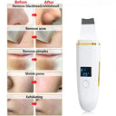 Ultrasonic Skin Scrubber Remover Blackhead Ultrasonic Peeling Facial Scrubber Shovel Deep Cleaning Face Lifting Remove Pore Acne  ourlum.com   