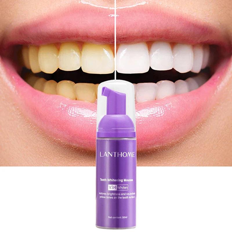 Brighter Smile Teeth Whitening Mousse: Deep Stain Removal & Fresh Breath