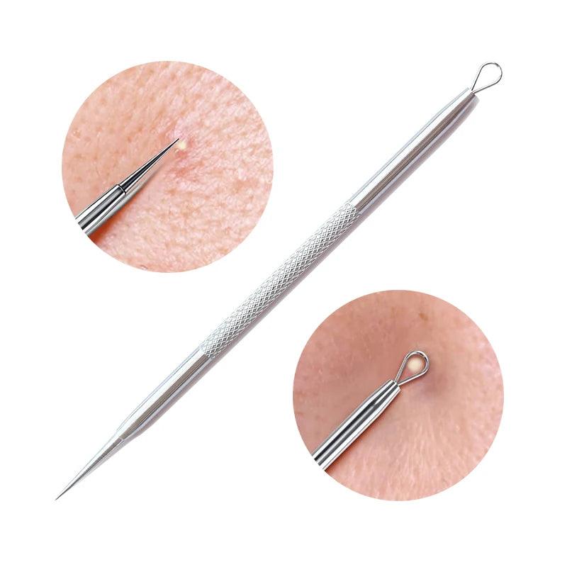 Skin Clear Pro Blemish Extractor Set  ourlum.com   