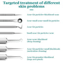 Flawless Skin Blackhead Removal Tool Set for Clear Complexion  ourlum.com   