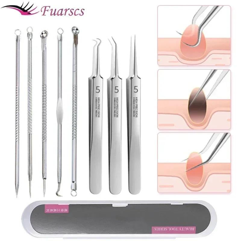 Professional Blackhead Removal Kit - Effective Acne Extractor Tool  ourlum.com   