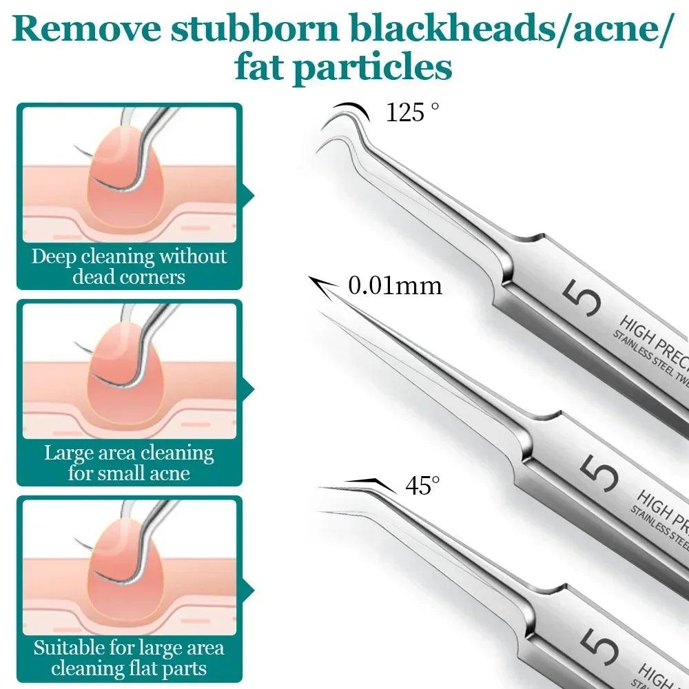 Professional Blackhead Removal Kit - Effective Acne Extractor Tool  ourlum.com   