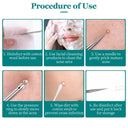 Professional Blackhead Removal Kit - Effective Acne Extractor Tool  ourlum.com   