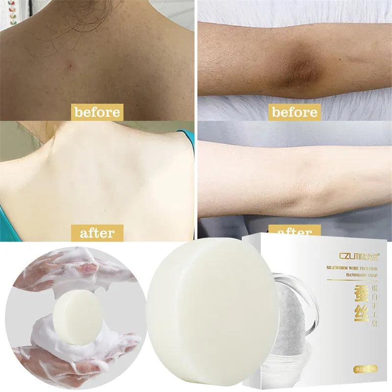 Radiant Skin Whitening Soap with Underarm Care & Age-Defying Formula  ourlum.com   