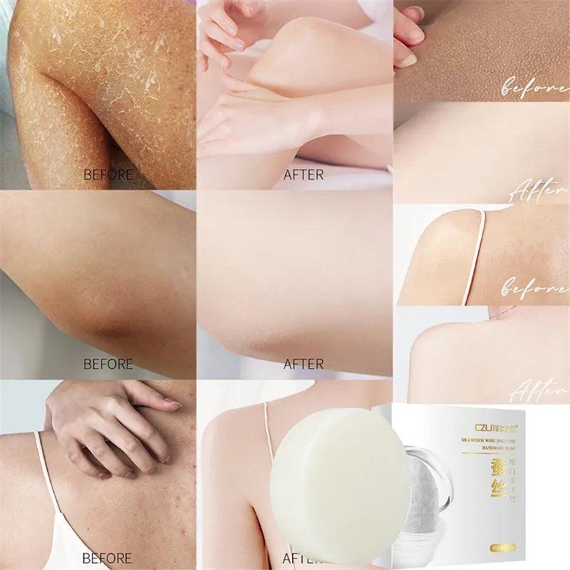 Radiant Skin Whitening Soap with Underarm Care & Age-Defying Formula  ourlum.com   