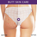 Acne Clearing Cream for Smooth and Radiant Buttocks and Thighs  ourlum.com   