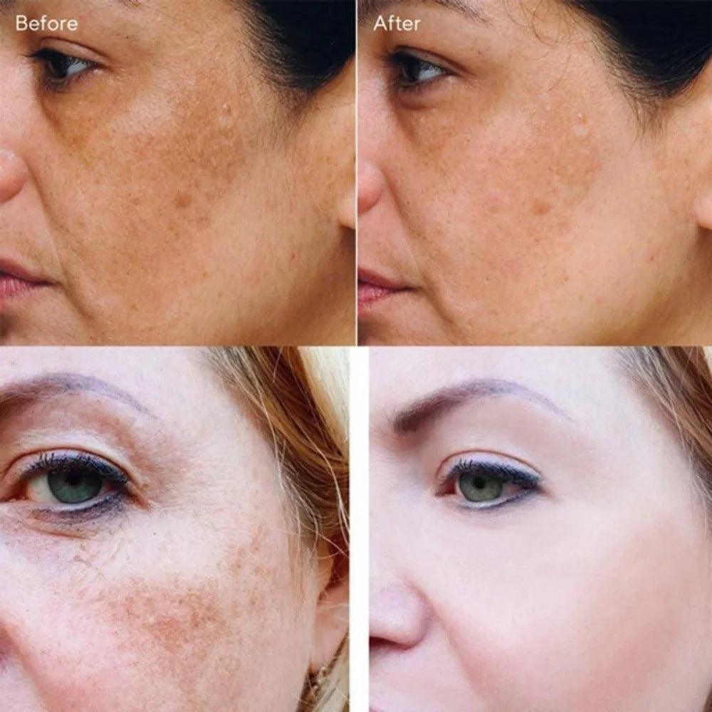 Radiant Skin Illuminating Cream - Diminish Dark Spots, Melasma, and Skin Fatigue  ourlum.com   