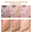 Radiant Skin Illuminating Cream - Diminish Dark Spots, Melasma, and Skin Fatigue  ourlum.com   