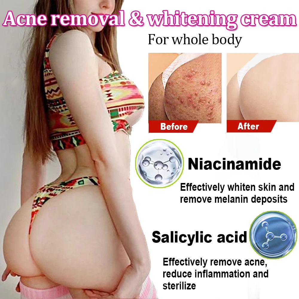 Niacinamide Enriched Booty Cream for Acne & Dark Spots - Skin Brightening Solution  ourlum.com   