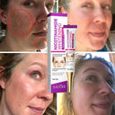 Radiant Skin Brightening Cream - Dark Spot Removal & Pigmentation Repair  ourlum.com   