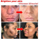 Radiant Skin Brightening Cream - Dark Spot Removal & Pigmentation Repair  ourlum.com   