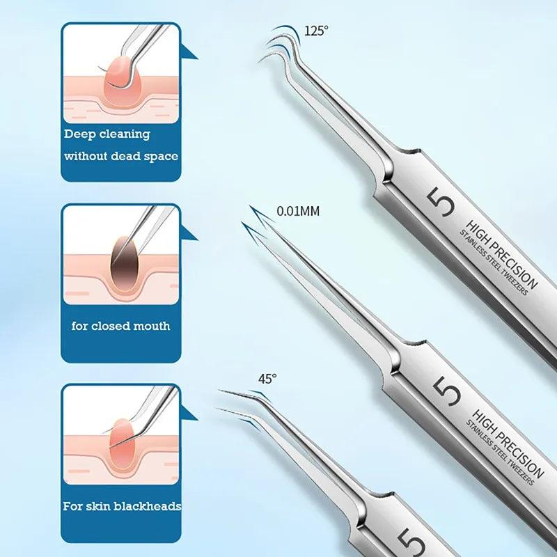 German Blackhead Extractor Tool Set with Ultra-Precision Technology for Professional Skin Care and Acne Removal  ourlum.com   
