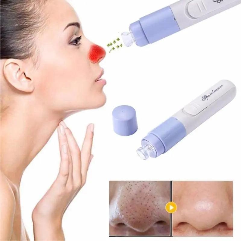 Portable Facial Pore Cleansing Beauty Device for Blackhead and Acne Removal  ourlum.com Default Title  