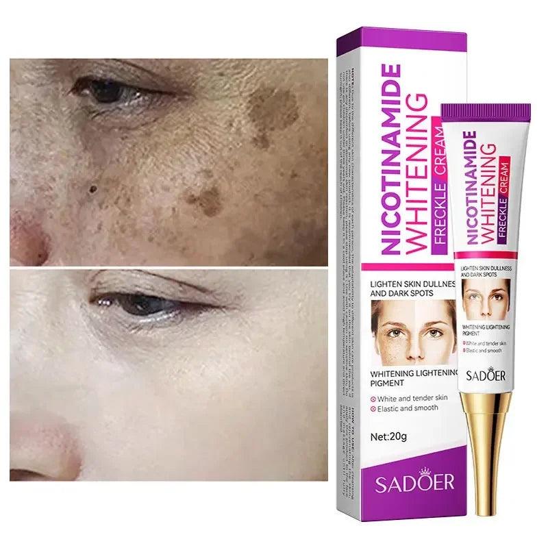 Radiant Skin Whitening and Brightening Cream for Acne Marks and Melasma  ourlum.com   