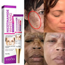 Radiant Skin Whitening and Brightening Cream for Acne Marks and Melasma  ourlum.com   