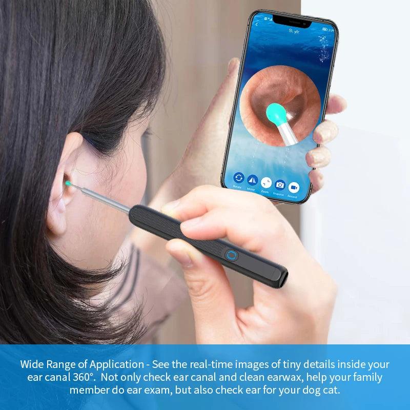 Smart Ear Care Kit: Wireless Otoscope Camera LED Light Ear Cleaner with High Precision Wax Removal  ourlum.com   