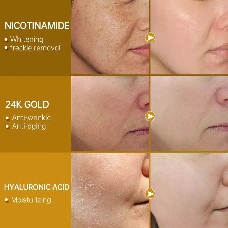Radiant 24K Gold Niacinamide Essence Serum for Youthful Skin  ourlum.com   