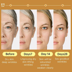 Anti-Wrinkle. Radiant Gold Niacinamide Serum: Youthful Skin Elixir