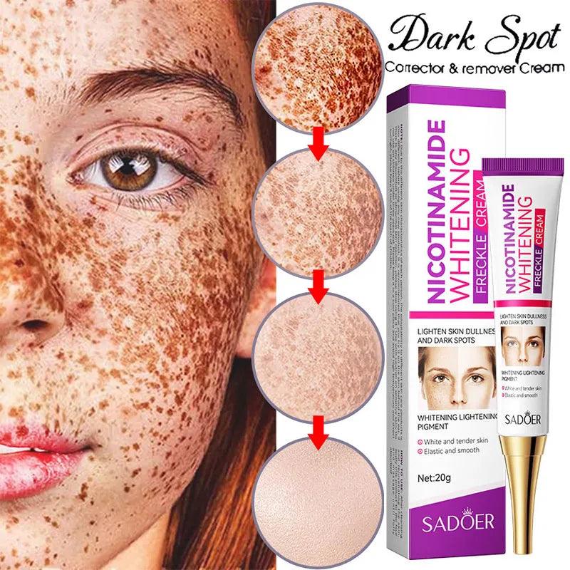Radiant Nicotinamide Freckle Removal Cream for Bright, Spotless Skin  ourlum.com   