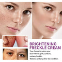 Radiant Nicotinamide Freckle Removal Cream for Bright, Spotless Skin  ourlum.com   