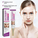 Radiant Nicotinamide Freckle Removal Cream for Bright, Spotless Skin  ourlum.com   