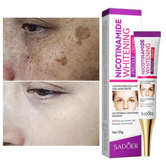 Radiant Skin Cream: Brighten Complexion & Fade Acne Marks