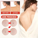 Acne Master Hydrocolloid Patches - Triple Extract Soothing Repair and 24-Hour Conditioning  ourlum.com   