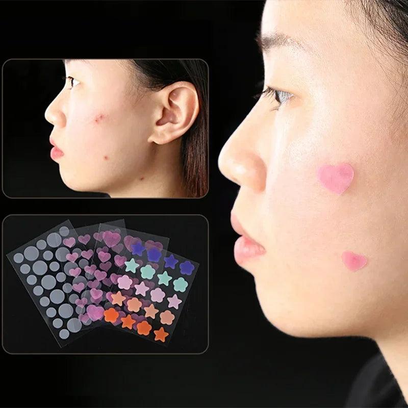 Star Pimple Patch Acne Colorful Invisible Skin Care Stickers Y2K Concealer Beauty Tool  ourlum.com   