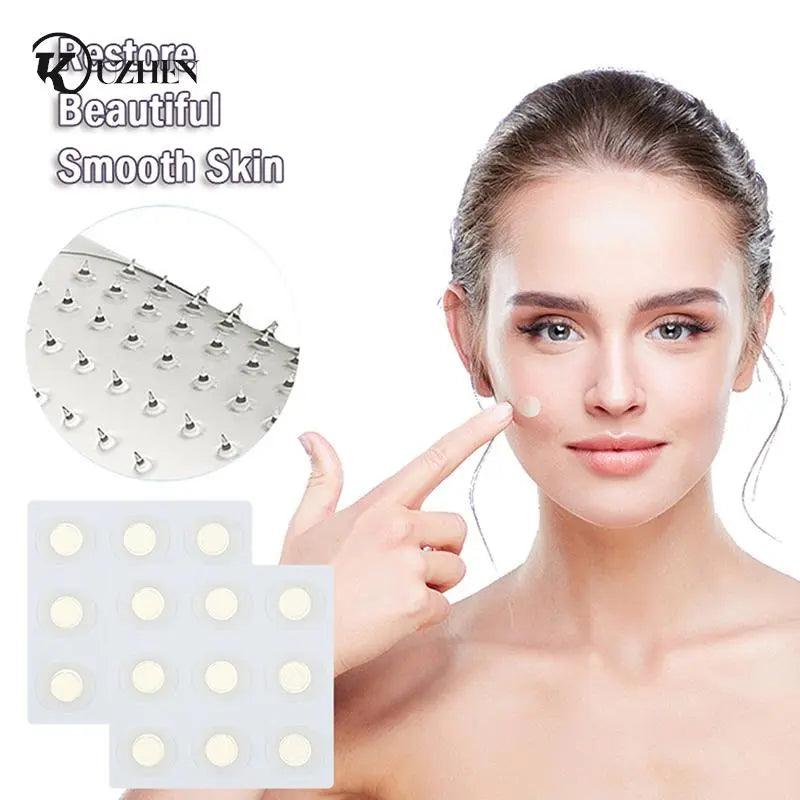 Acne Clear Microneedle Patches for Blemish-Free Skin  ourlum.com   