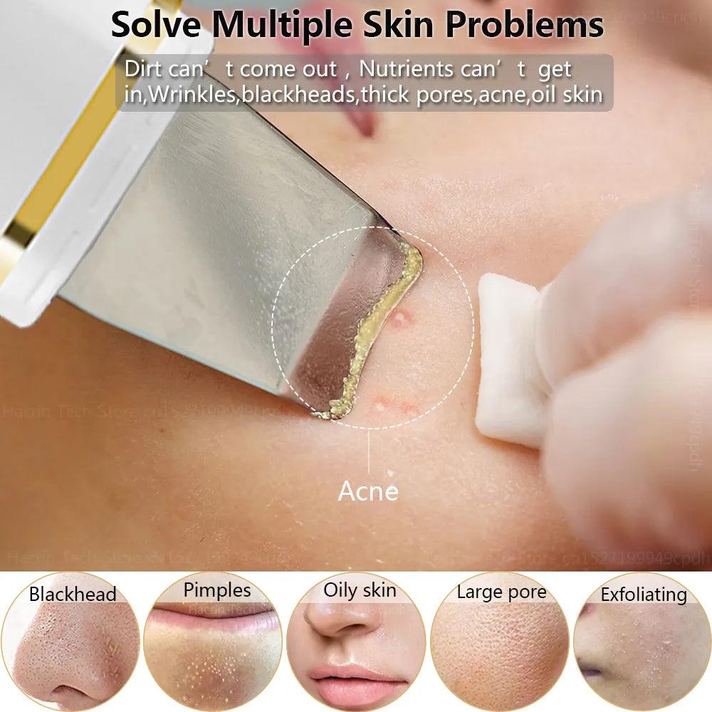 Ultimate Ultrasonic Skin Scrubber for Deep Cleansing and Skin Transformation  ourlum.com   