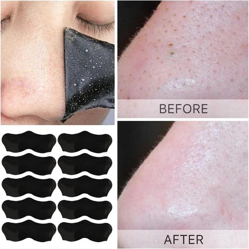 Blackhead Removal Peel Mask - Pore Cleansing Nose Strips Kit  ourlum.com   