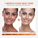 Skin Brightening Vitamin C Serum with Hyaluronic Acid and Niacinamide  ourlum.com   