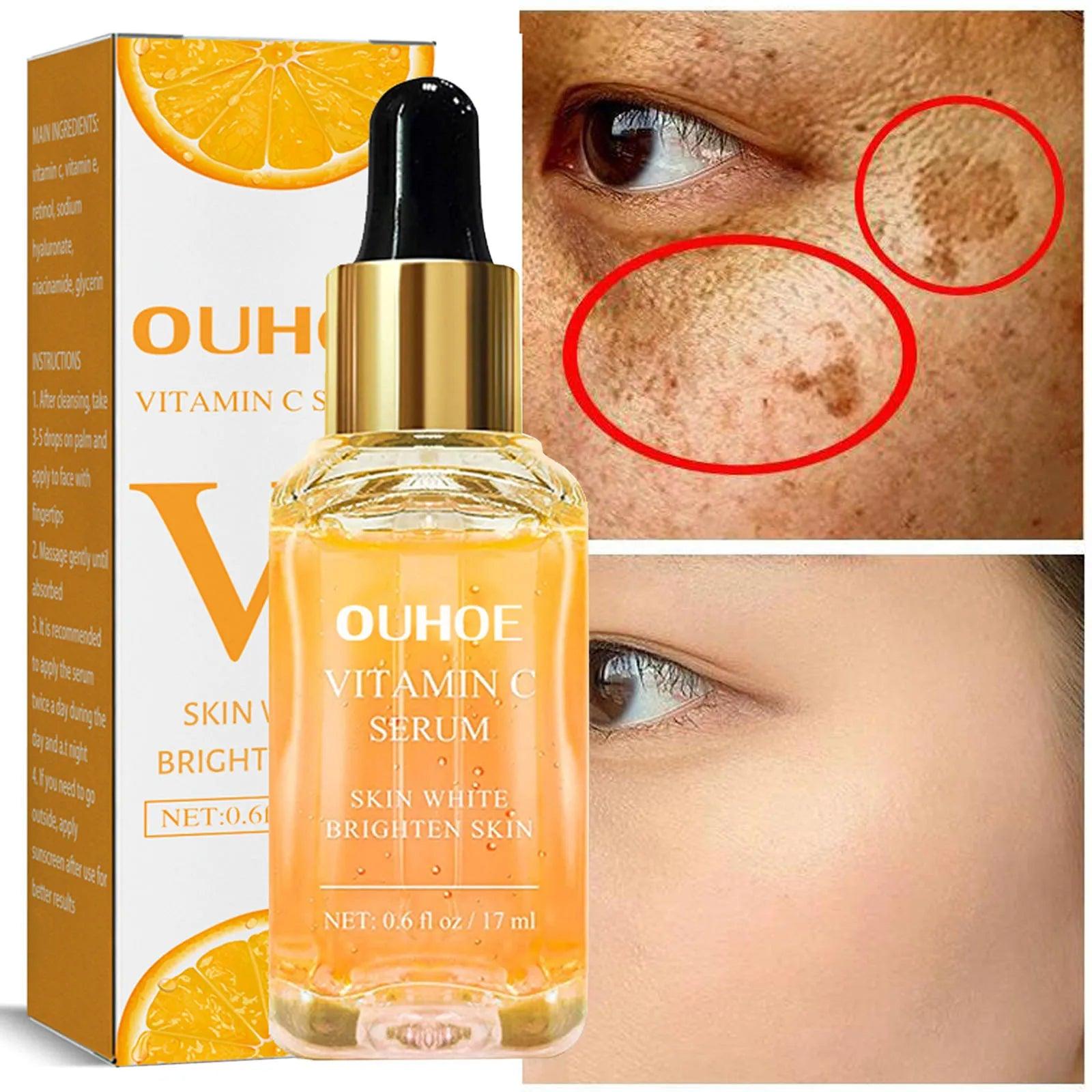 Radiant Glow Vitamin C Serum - Advanced Anti-Aging Skincare Blend  ourlum.com   