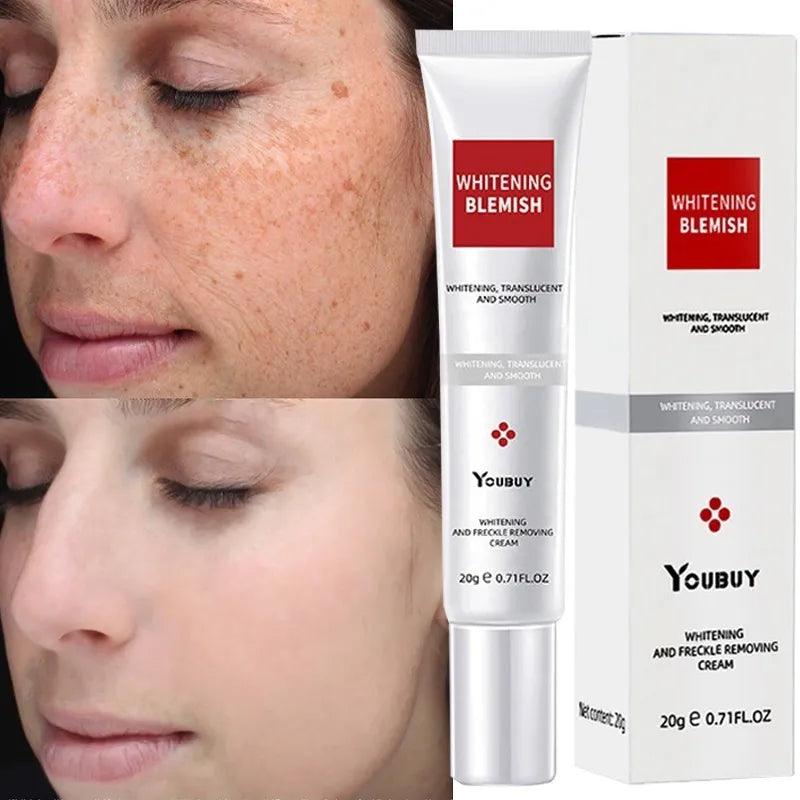 Advanced Melasma Whitening Cream with Niacinamide Skin Brightening and Repair Formula  ourlum.com Default Title  