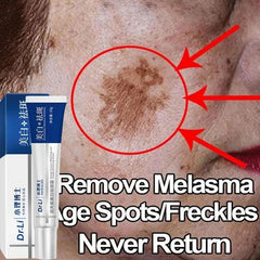 Radiant Skin Brightening: Melasma & Dark Spot Removal Formula