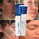 Skin Brightening Cream with Melasma and Dark Spot Removal, Anti-Pigmentation Formula for Youthful Radiance  ourlum.com   