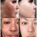 Radiant Skin Brightening Melasma Dark Spot Removal Cream